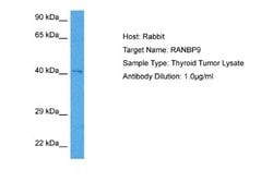 RANBP9 Rabbit anti-Human, Polyclonal, Novus Biologicals 0.1 mL | Buy Online | Novus Biologicals | Fisher Scientific